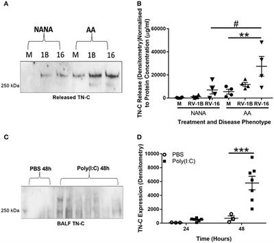 Airway Epithelial Cells Generate Pro-inflammatory Tenascin-C and Small Extracellular Vesicles in Response to TLR3 Stimuli and Rhinovirus Infection